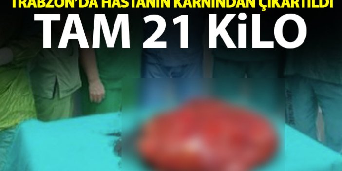 Trabzon'da hastanın karnından 21 kilo tümör çıktı