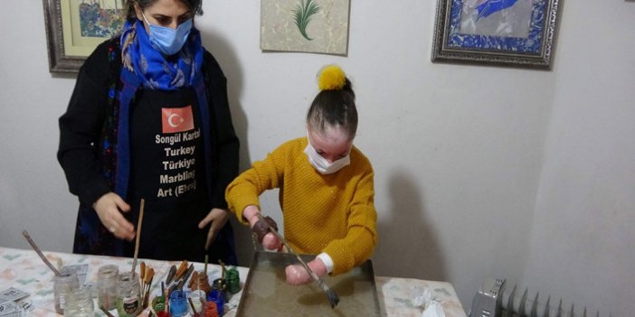 Kelebek hastası Trabzonlu Ayşenur ebru sanatına tutundu