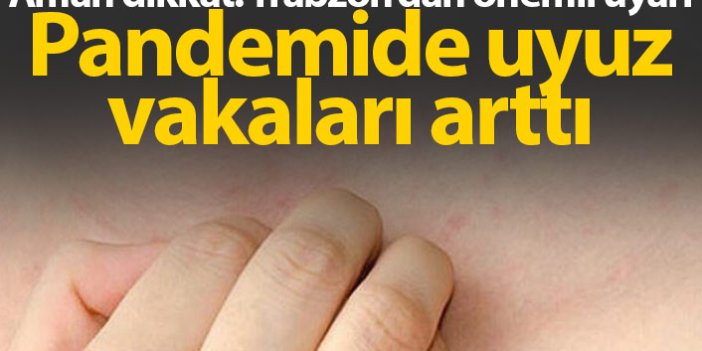 Trabzon'da önemli uyarı! Pandemide uyuz arttı