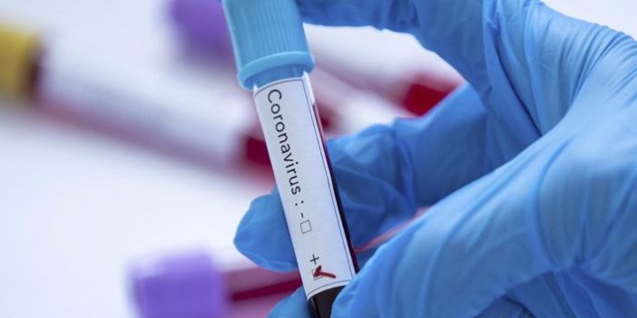Türk bilim insanı umutlandıran çalışma! Koronavirüsü 48 saatte yok edecek