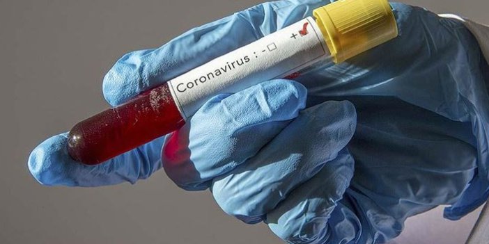 Yeni koronavirüs testi geliştirildi! 5 dakikada buluyor