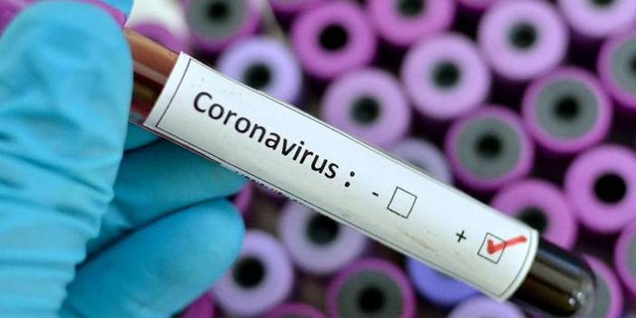 Türkiye'nin günlük koronavirüs tablosu açıklandı 17 Mayıs 2021