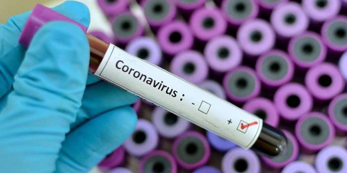 Türkiye'nin günlük koronavirüs tablosu açıklandı. 21 Mayıs 2021