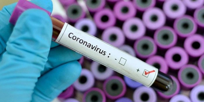 Türkiye'de günün koronavirüs raporu 23.05.20221