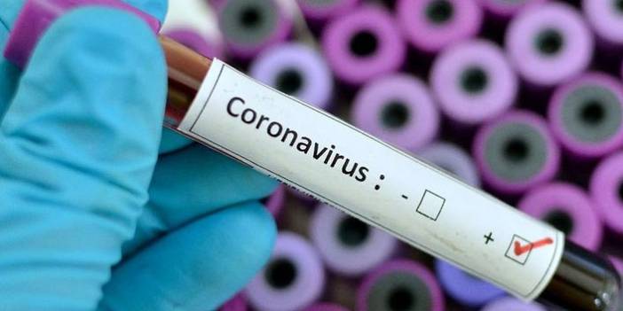 Türkiye'nin günlük koronavirüs tablosu açıklandı. 26 Mayıs 2021