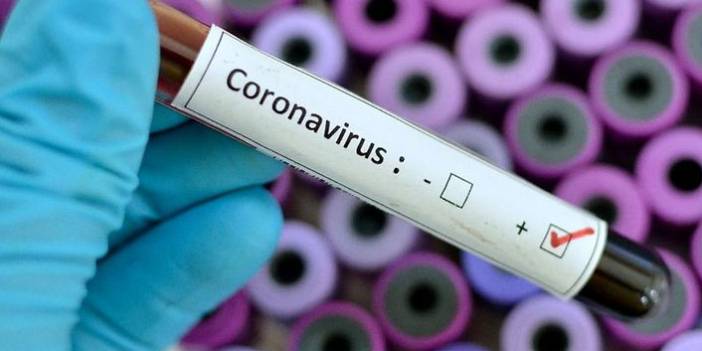 Türkiye'nin günlük koronavirüs tablosu açıklandı. 1 Haziran 2021