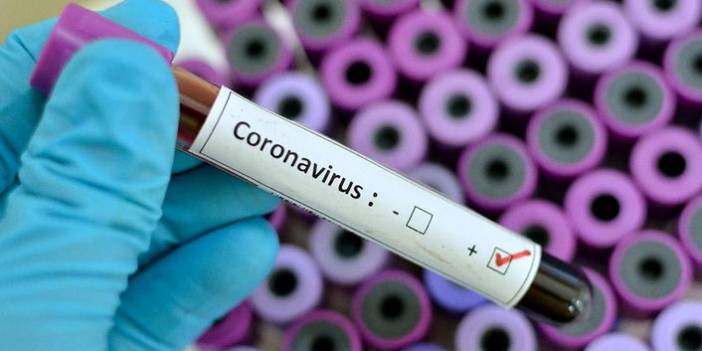 Türkiye'nin günlük koronavirüs tablosu açıklandı. 3Haziran 2021