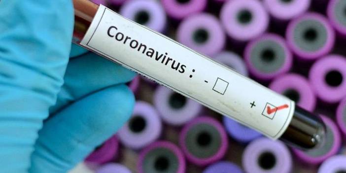 Türkiye'nin günlük koronavirüs tablosu açıklandı. 4 Haziran 2021