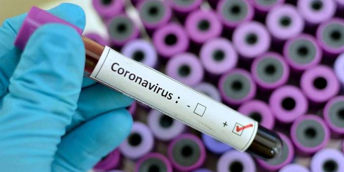 Türkiye'nin günlük koronavirüs tablosu açıklandı. 6 Haziran 2021