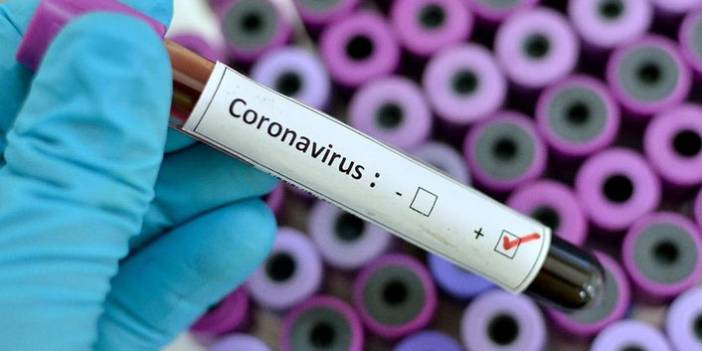 Türkiye'nin günlük koronavirüs tablosu açıklandı. 10 Haziran 2021