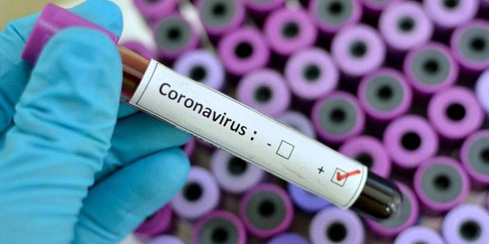 Türkiye'nin günlük koronavirüs tablosu açıklandı 12 Haziran 2021