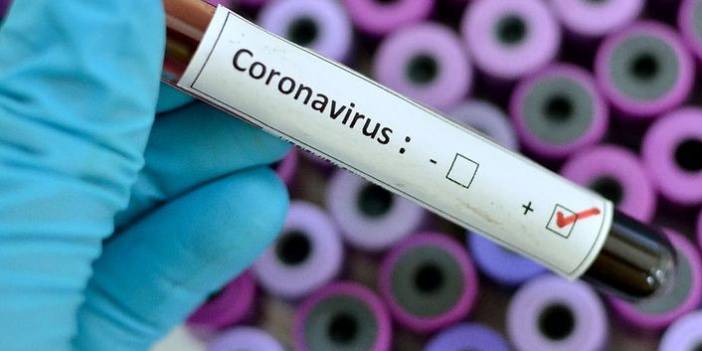 Türkiye'nin günlük koronavirüs tablosu açıklandı. 15 Haziran 2021