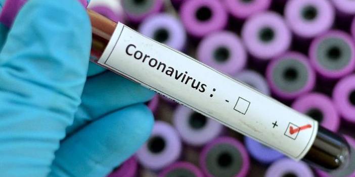 Türkiye'nin günlük koronavirüs tablosu açıklandı. 21 Haziran 2021