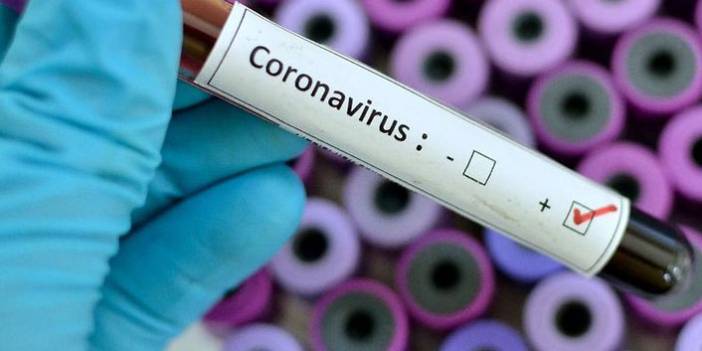 Türkiye'nin günlük koronavirüs tablosu açıklandı 24 Haziran 2021