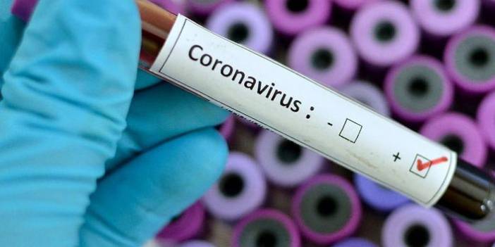 Türkiye'nin günlük koronavirüs tablosu açıklandı. 26 Haziran 2021