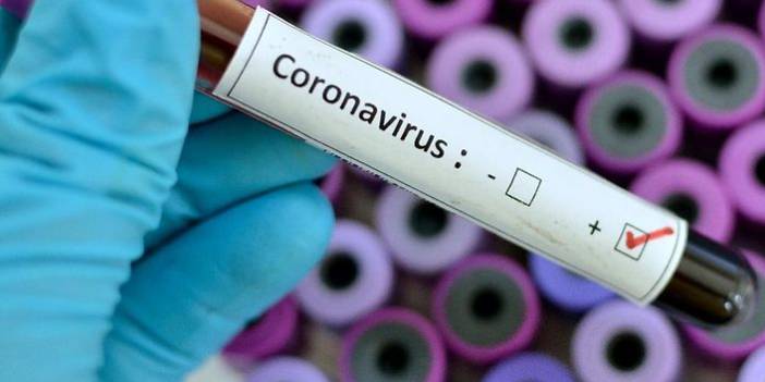 Türkiye'nin günlük koronavirüs tablosu açıklandı. 3 Temmuz 2021