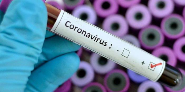 Türkiye'nin günlük koronavirüs ve aşı tablosu açıklandı - 12 Temmuz 2021 Pazartesi