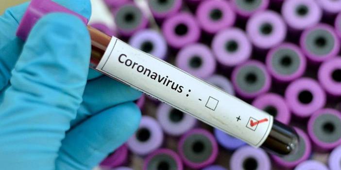 Türkiye'nin günlük koronavirüs ve aşı tablosu açıklandı - 20 Temmuz 2021 Salı
