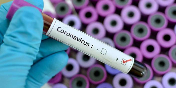 Türkiye'nin günlük koronavirüs ve aşı tablosu açıklandı - 24 Temmuz 2021 Cumartesi