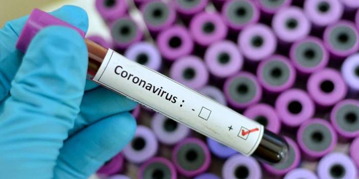 Türkiye'nin günlük koronavirüs ve aşı tablosu açıklandı - 26 Temmuz 2021 Pazartesi