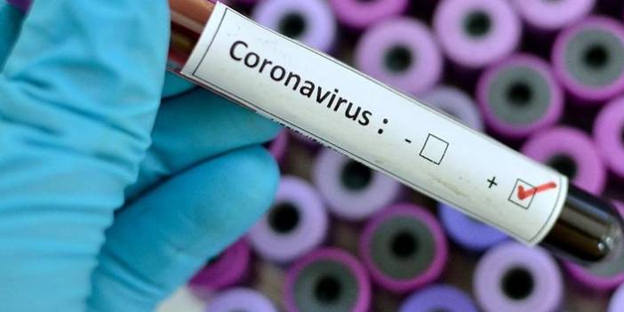 Türkiye'nin günlük koronavirüs ve aşı tablosu açıklandı - 03 Ağustos 2021 Salı