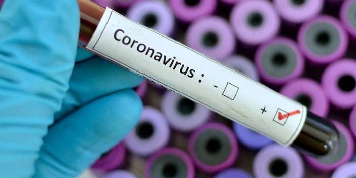 Türkiye'nin günlük koronavirüs ve aşı tablosu açıklandı - 07 Ağustos 2021 Cumartesi