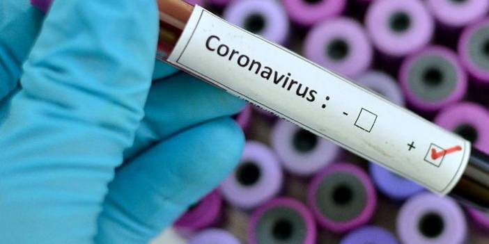 Türkiye'nin günlük koronavirüs ve aşı tablosu açıklandı - 10 Ağustos 2021 Salı