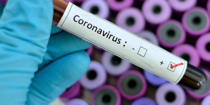 Türkiye'nin günlük koronavirüs ve aşı tablosu açıklandı - 22 Ağustos 2021 Pazar