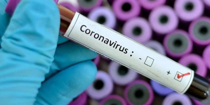 Türkiye'nin günlük koronavirüs ve aşı tablosu açıklandı - 30 Ağustos 2021 Pazartesi