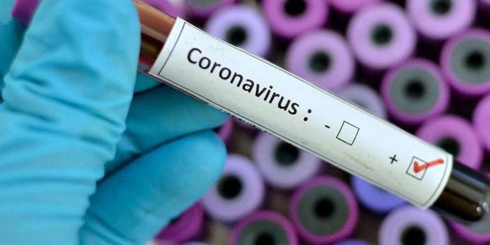 Türkiye'nin günlük koronavirüs ve aşı tablosu açıklandı - 02 Eylül 2021 Perşembe
