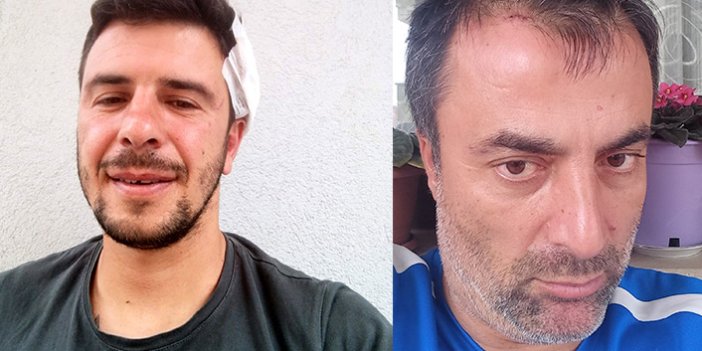 Trabzon'da antrenörlerin futbol sohbetinde levyeli kavga çıktı: 2 yaralı