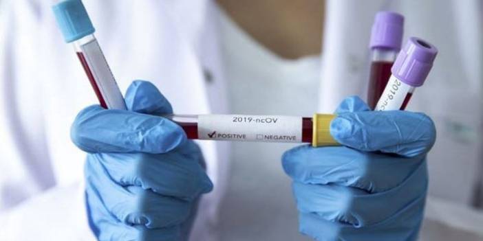 Türkiye'nin günlük koronavirüs ve aşı tablosu açıklandı - 27 Kasım 2021 Cumartesi