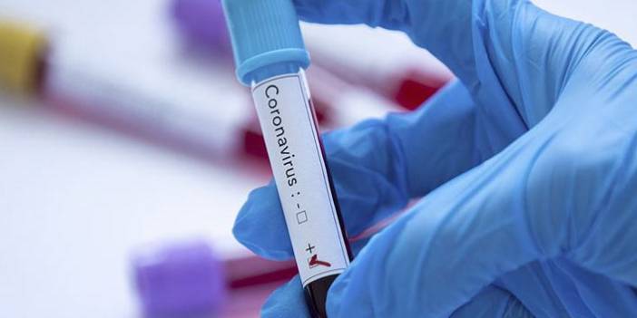 Türkiye'nin günlük koronavirüs ve aşı tablosu açıklandı - 21 Aralık 2021 Salı
