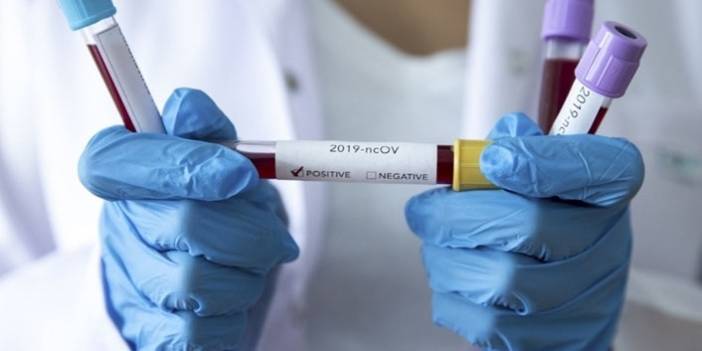 Vaka sayıları uçuyor! Türkiye'nin günlük koronavirüs ve aşı tablosu açıklandı - 05 Ocak 2022 Çarşamba