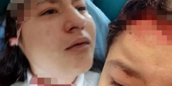 Selfie çeken 14 yaşındaki çocuğa 5 köpek saldırdı