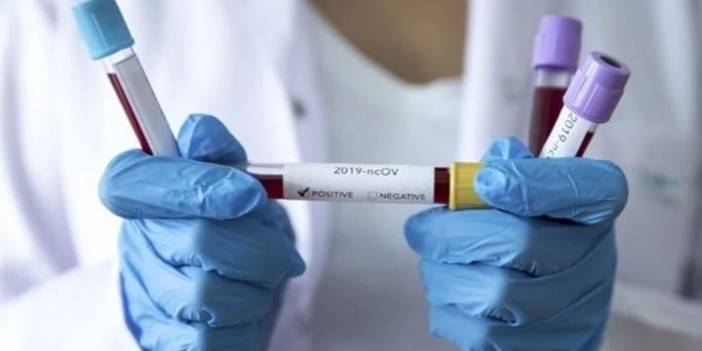 Türkiye'nin günlük koronavirüs ve aşı tablosu açıklandı - 06 Şubat 2022 Pazar