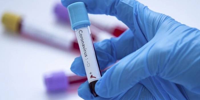 Türkiye'nin günlük koronavirüs ve aşı tablosu açıklandı - 12 Şubat 2022 Cumartesi