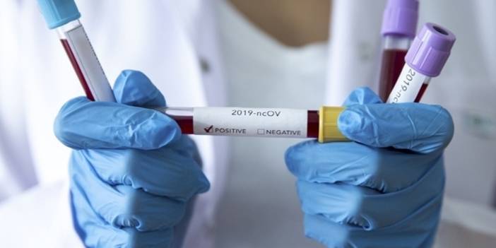 Türkiye'nin günlük koronavirüs ve aşı tablosu açıklandı - 19 Şubat 2022 Cumartesi