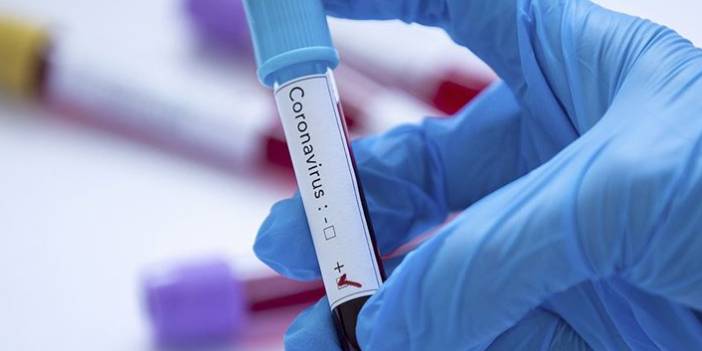 Türkiye'nin günlük koronavirüs ve aşı tablosu açıklandı - 27 Şubat 2022 Pazar