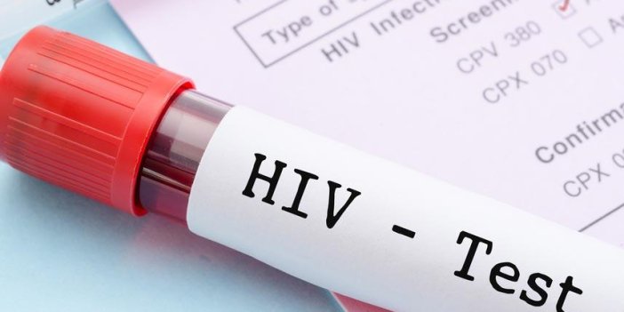 AIDS nedir? Belirtileri nelerdir? Hangi yollarla bulaşır?