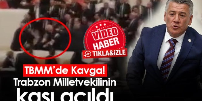 TBMM’de Kavga! Trabzon Milletvekili'ne yumruklu saldırı