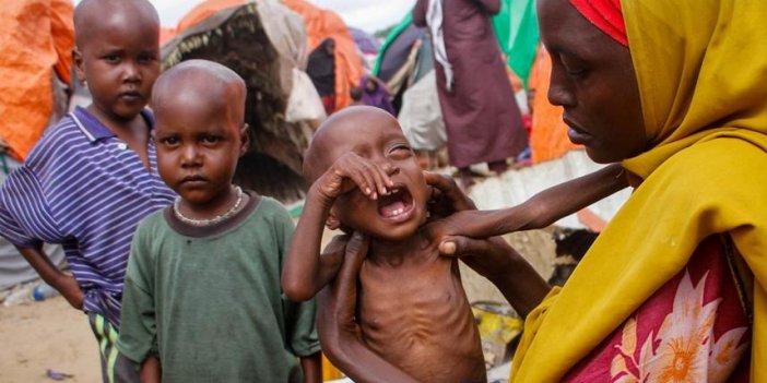 Somali'de yaklaşık 8 milyon kişi yetersiz besleniyor