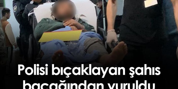 Samsun'da polisi bıçaklayan şahıs bacağından vuruldu