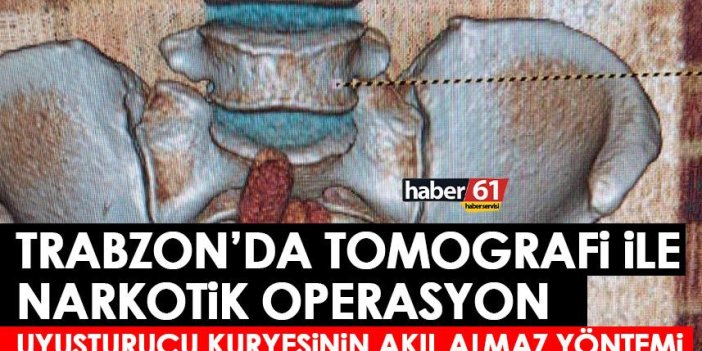 Trabzon’da uyuşturucu kaçakçısının akıl almaz yöntemi! Tomografi sonrası yakalandı