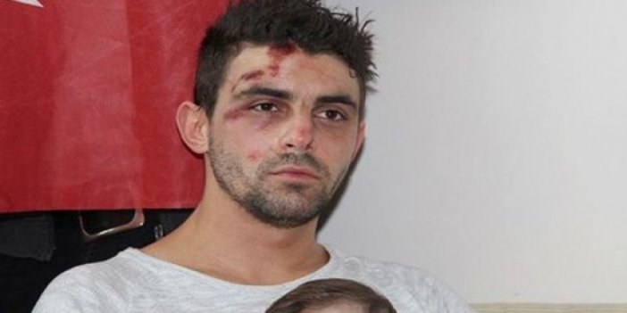 Hollanda polisinin köpekle saldırdığı Trabzonlu o anları anlattı