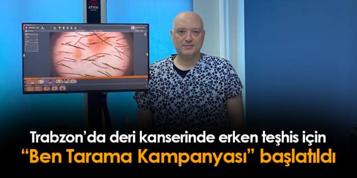 Trabzon'da cilt kanserinde erken teşhis için "Ben Tarama Kampanyası" başlatıldı