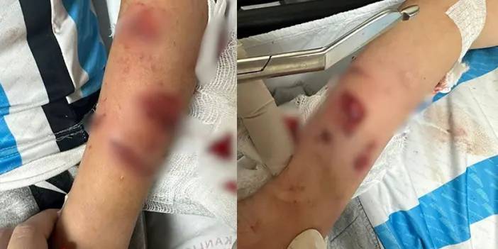 Sevdiği köpeğin saldırısına uğradı! 12 yaşındaki çocuk yaralandı